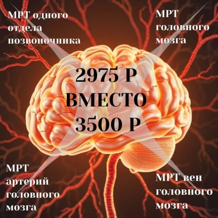 День Мозга и Позвоночника: скидки до 25% на МРТ и УЗИ!
