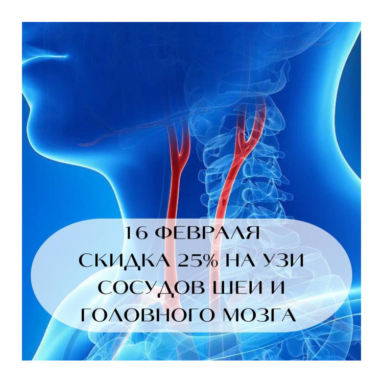 УЗИ сосудов шеи и головного мозга со скидкой 25% - только 16 февраля!