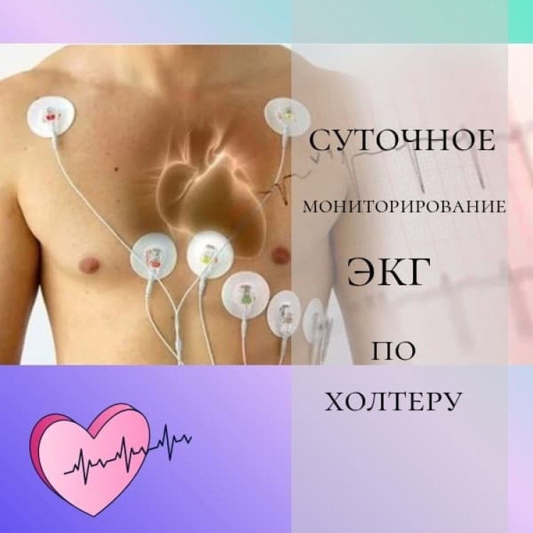 Скрытые проблемы сердца: как 24-часовой Холтер помогает там, где обычное ЭКГ бессильно